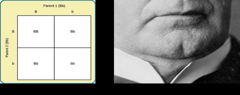 Image (a) is a Punnett square showing the four possible combinations (Bb, bb, Bb, bb) resulting from the pairing of a bb father and a Bb mother. Image (b) is a close-up photograph showing a cleft chin.