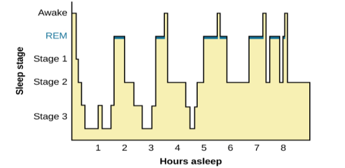 This is a hypnogram showing the transitions of the sleep cycle during a typical eight hour period of sleep. During the first hour, the person goes through stages 1 and 2 and ends at 3. In the second hour, sleep oscillates in stage 3 before attaining a 30-minute period of REM sleep. The third hour follows the same pattern as the second, but ends with a brief awake period. The fourth hour follows a similar pattern as the third, with a slightly longer REM stage. In the fifth hour, stage 3 is no longer reached. The sleep stages are fluctuating from 2, to 1, to REM, to awake, and then they repeat with shortening intervals until the end of the eighth hour when the person awakens.
