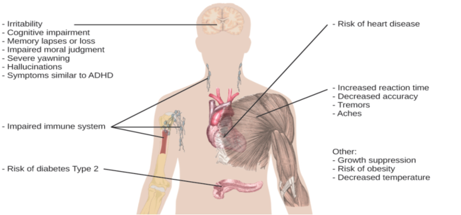 An illustration of the top half of a human body identifies the locations in the body that correspond with various adverse affects of sleep deprivation. The brain is labeled with “Irritability,” “Cognitive impairment,” “Memory lapses or loss,” “Impaired moral judgment,” “Severe yawning,” “Hallucinations,” and “Symptoms similar to ADHD.” The heart is labeled with “Risk of heart disease.” The muscles are labeled with “Increased reaction time,” “Decreased accuracy,” “Tremors,” and “Aches.” There is an organ near the stomach labeled “Risk of diabetes Type 2.” Various parts of the neck, arm, and underarm are labeled “Impaired immune system.” Other risks include “Growth suppression,” “Risk of obesity,” “Decreased temperature.”