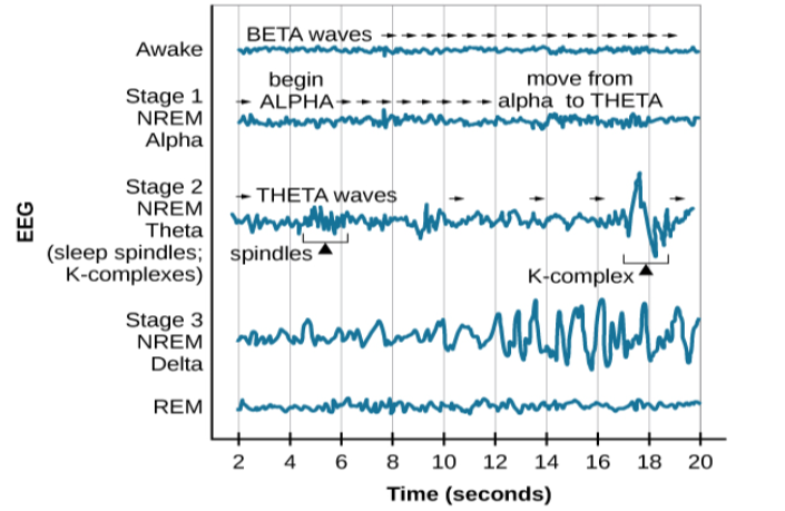 A graph has a y-axis labeled “EEG” and an x-axis labeled “time (seconds.) Plotted along the y-axis and moving upward are the stages of sleep. First is REM, followed by Stage 3 NREM Delta, Stage 2 NREM Theta (sleep spindles; K-complexes), Stage 1 NREM Alpha, and Awake. Charted on the x axis is Time in seconds from 2–20 in 2 second intervals. Each sleep stage has associated wavelengths of varying amplitude and frequency. Relative to the others, “awake” has a very close wavelength and a medium amplitude. Stage 1 is characterized by a generally uniform wavelength and a relatively low amplitude which doubles and quickly reverts to normal every 2 seconds. Stage 2 is comprised of a similar wavelength as stage 1. It introduces the K-complex from seconds 10 through 12 which is a short burst of doubled or tripled amplitude and decreased wavelength. Stage 3 has a more uniform wave with gradually increasing amplitude. Finally, REM sleep looks much like stage 2 without the K-complex.