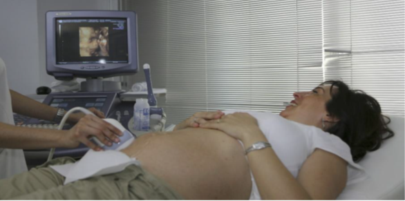 Picture of transabdominal ultrasound of pregnant woman.