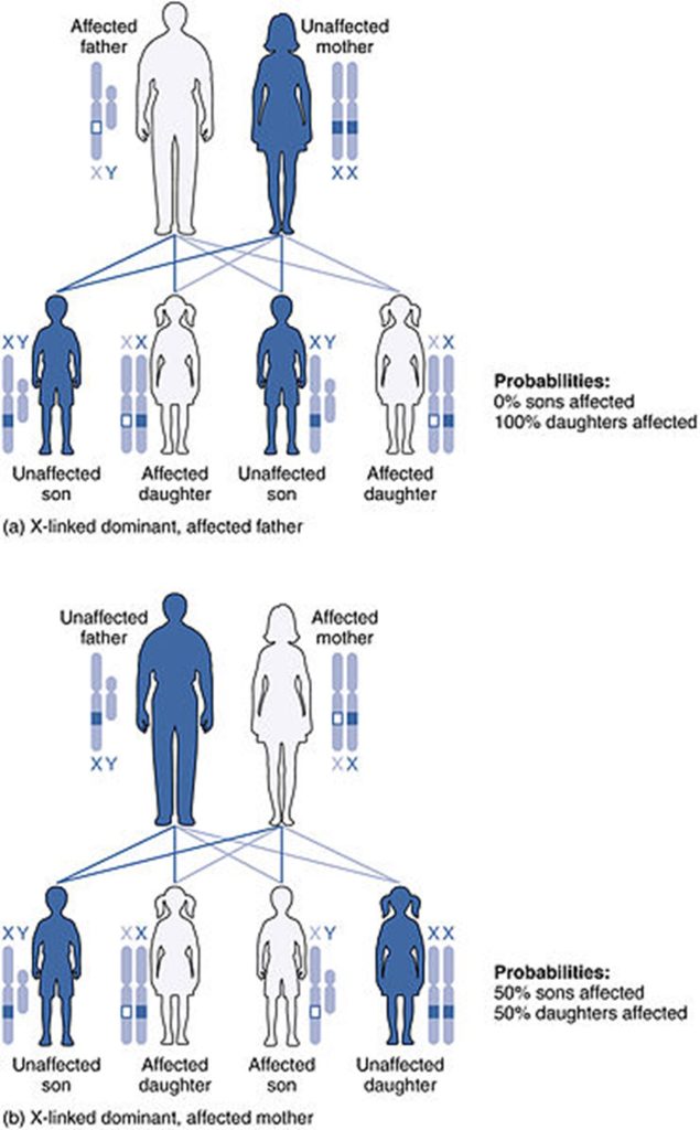 Illustration of how X-linked Dominant Inheritance genes are transmitted.