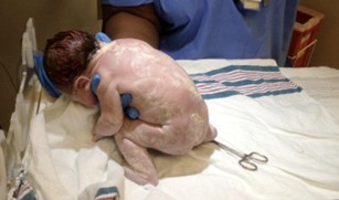 Newborn covered in vernix