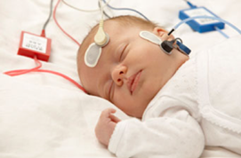 Infant sleeping while Auditory Brainstem Response (ABR) test is being taken.