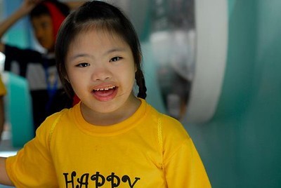 Photo a young girl with Down's Syndrome.