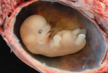 Human embryo at approximately 8 weeks gestational age.