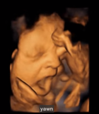 4-D Image of a Fetus yawning.