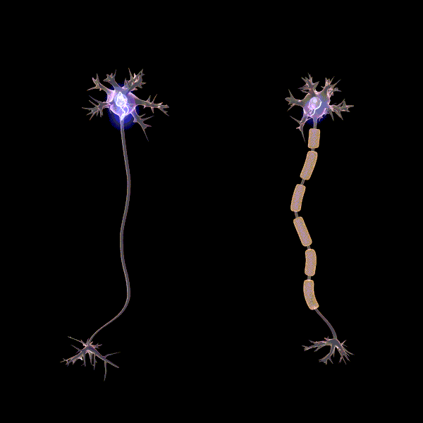 Two neurons (nerve cells) one with myelination (insulation) and one without. The neurons spin and show you how the nerve signal travels faster in a myelinated (insulated) neuron.