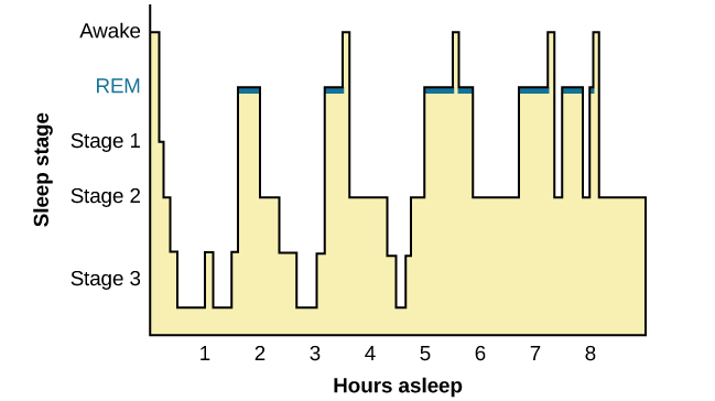 This is a hypnogram showing the transitions of the sleep cycle during a typical eight hour period of sleep. During the first hour, the person goes through stages 1,2,3 and ends at 4. In the second hour, sleep oscillates between 3 and 4 before attaining a 30-minute period of REM sleep. The third hour follows the same pattern as the second, but ends with a brief awake period. The fourth hour follows a similar pattern as the third, with a slightly longer REM stage. In the fifth hour, stages 3 and 4 are no longer reached. The sleep stages are fluctuating from 2, to 1, to REM, to awake, and then they repeat with shortening intervals until the end of the eighth hour when the person awakens.