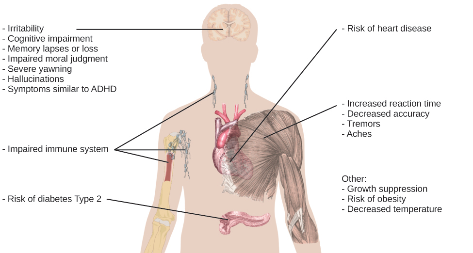 Picture of body. Head label include Irritability. cognitive impairments. memory lapses, impaired moral judgment, severe yawning, hallucinations, symptoms similar to ADHD. Body labels include risk of heart disease, increased reaction time, decreased accuracy, tremors, aches, impaired immune system, risk of type 2 diabetes, growth suppression, risk of obesity, decreased temperature