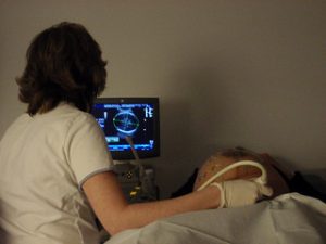 A woman giving a patient a sonogram