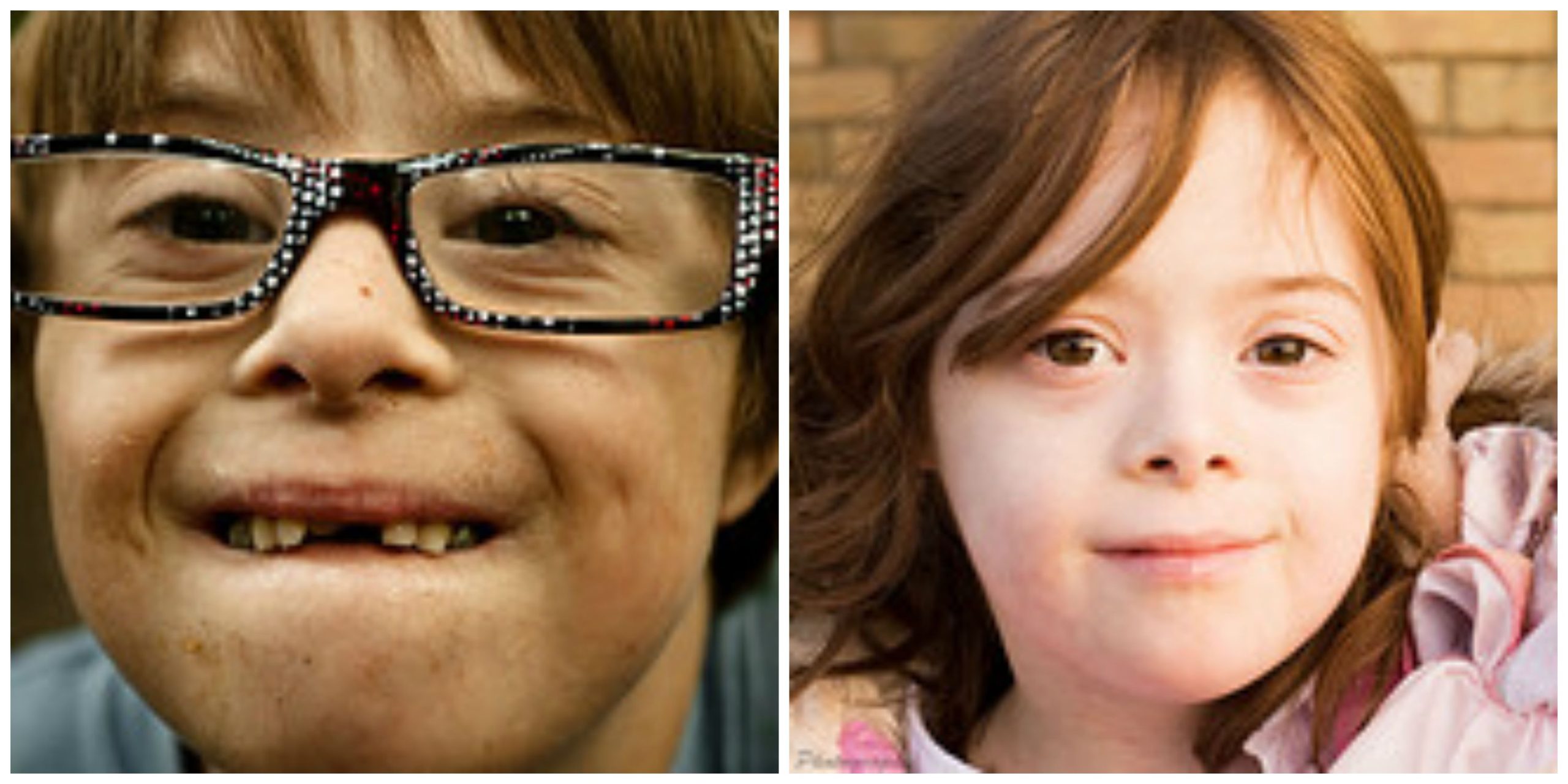 a young boy and young girl with down syndrome