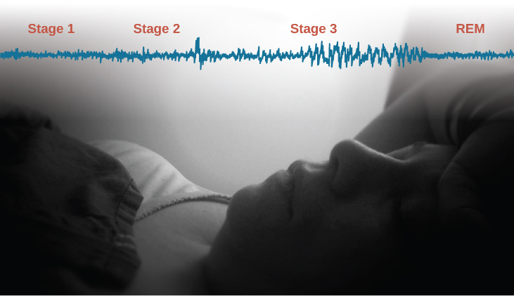 A photograph shows a person sleeping. Superimposed across the top of the picture is a line representing brainwave activity across the five stages of sleep. Above the line, from left to right, it reads stage 1, stage 2, stage 3, stage 4, and stage 5. The wave amplitude is highest in late stage 2, and near the end of stage 3 through stage 4. The wavelength I longer from late stage 2 through stage 4.