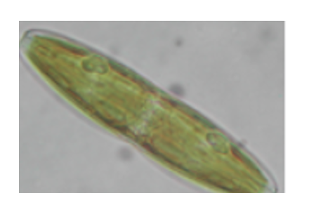 Figure 3. Diatom under the light microscope, (1000X). Author: Dmitry Brogun Green cigar shape cell.