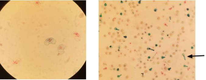 Figure 4a depicts gymnosperm pollen grains using compound microscopy. b. depicts pollen tubes using compound microscopy. In Figure 4b an arrow points to pollen tube.