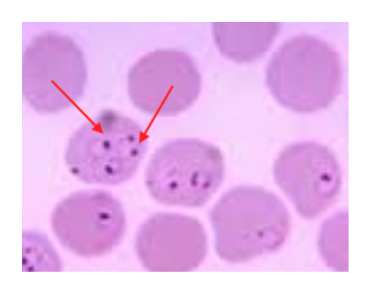 Figure 4. Red blood cells infected with the Plasmodium falciparum, malaria causing Apicomplexan, under the light microscope, arrows indicate its colocalization within the erythrocyte (1000X). Author: Dmitry Brogun Pink colored oval shape cells with red small dots inside of them.