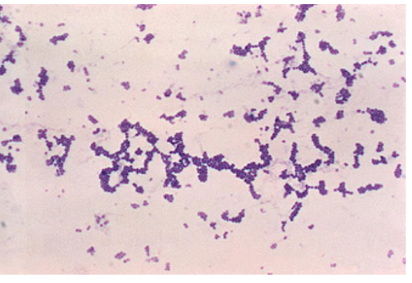 Figure 3. Staphylococcus aureus (Gram +) under the light microscope 1000X. Author: Dmitry Brogun. Purple color round cells. Looks like grapes.