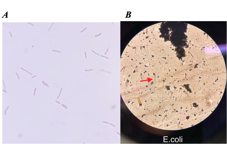 Figure 4. Escherichia coli under light microscopy. Escherichia coli: Escherichia coli is a Gram-negative bacillus. Measure the length and width of a typical rod. A-Gram Stain, light microscopy 400X. B. Flagella stain 100X (red arrow pointing to the flagella) Author: Dmitry Brogun Part A cigar shape cells. Part B Cigar shape brown cells with hair-like extensions at one end.