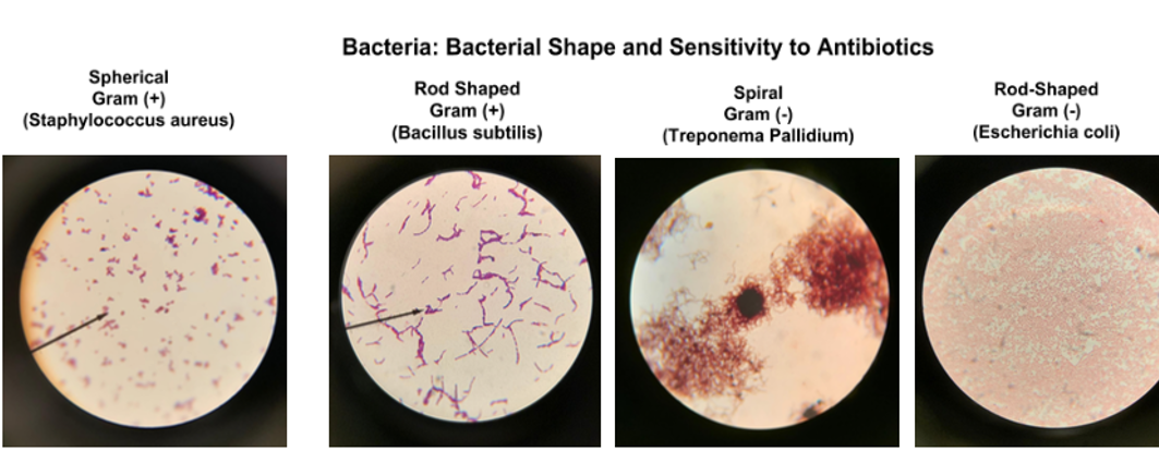 Figure 6. The prokaryotic survey, part 2. (Photographs and the panel by Dmitry Brogun) Four circles depicting different types of bacteria cells. In circle one round purple cells, in circle two cigar-shaped brown cells, in circle three red. round cells, in circle 4 cigar-shaped cells.